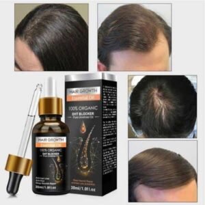 Hair Growth Essential Oil In Pakistan